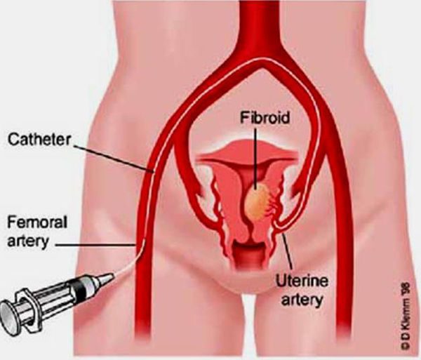 �����ʽ��� �ӹ�����˨������